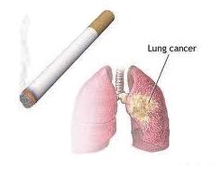 Smoking after cancer diagnosis ups death risk: study