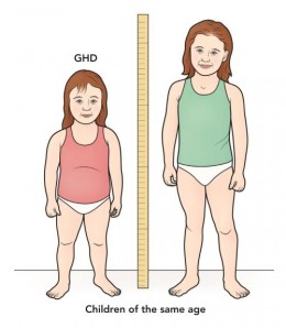 Kids short stature condition